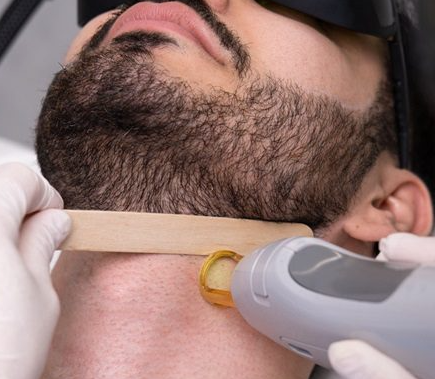 The Benefits of Laser Beard Shaping