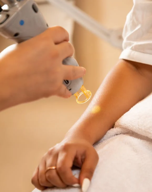 Everything You Need to Know About the Candela GentleMax Pro: The Ultimate Laser Hair Removal Solution