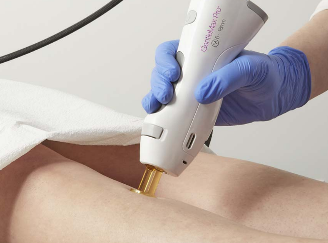 Ask an Esthetician: 5 Laser Hair Removal Questions You’re Too Embarrassed to Ask