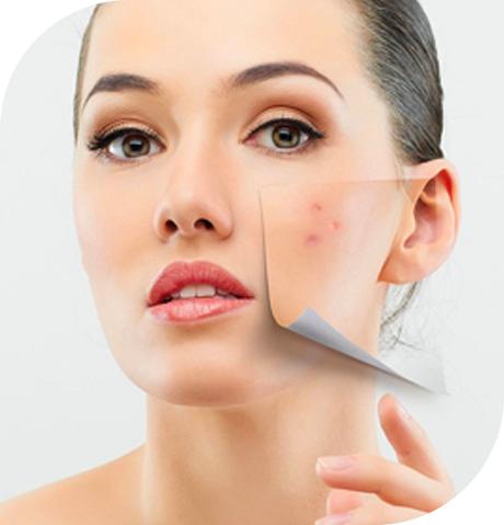 Benefits of having eMatrix done!