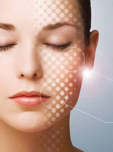 How eMatrix improves acne scars and other types of scarring