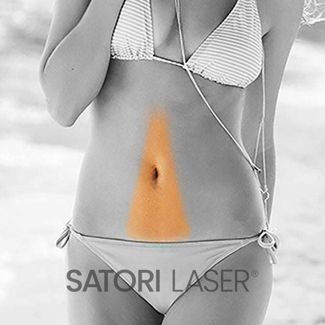 Belly Extension (F) - Satori Laser