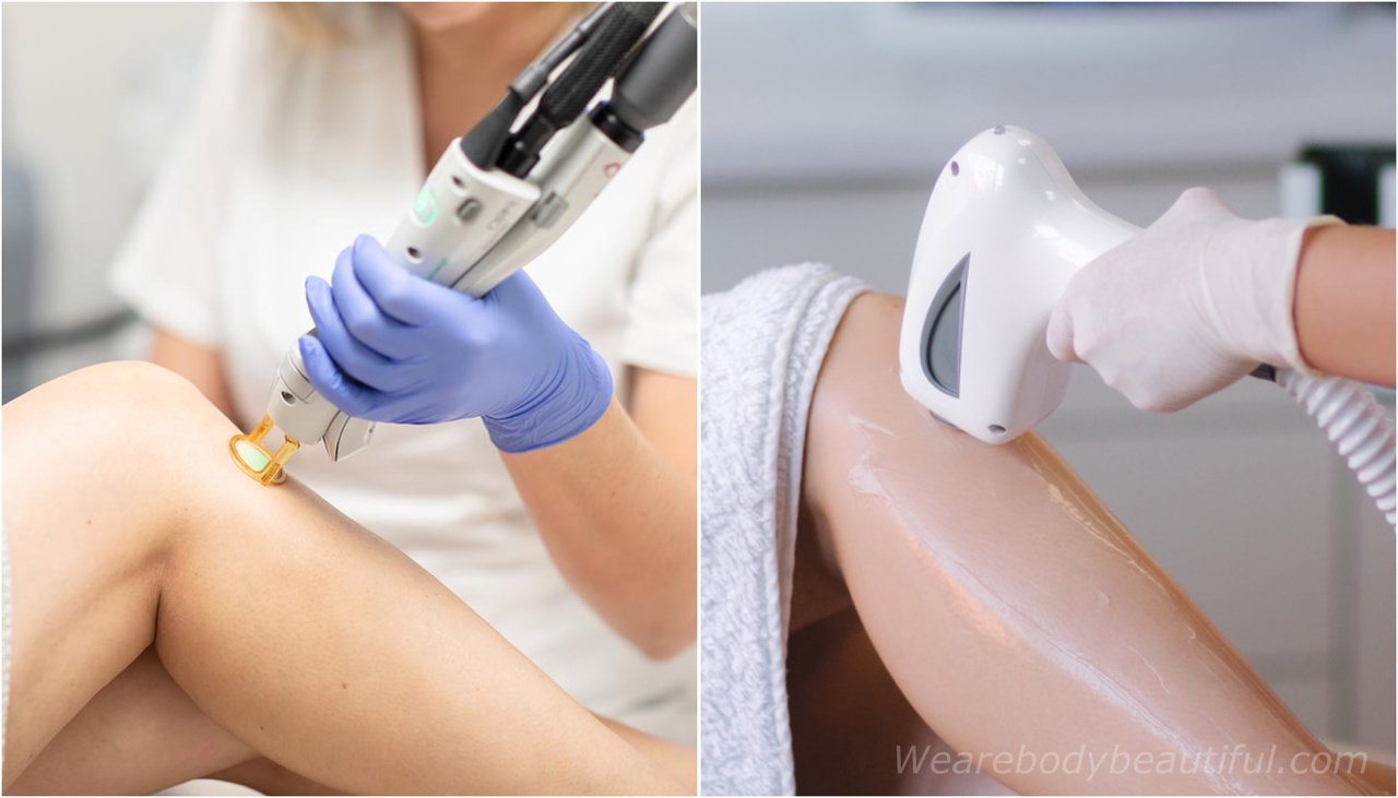IPL or Gentle MaxPro Series Laser?