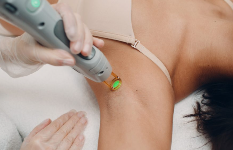 Vital Factors in Choosing Laser Hair Removal