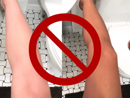 Why Avoid Self-Tanning before Laser Hair Removal?