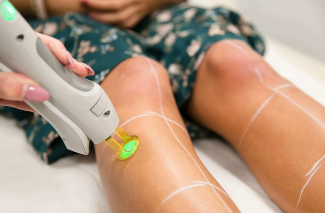 Who is Suitable for Laser Hair Removal?