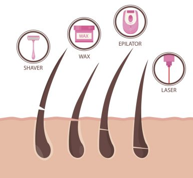 Is Laser Hair Removal Really More Expensive Than Waxing?