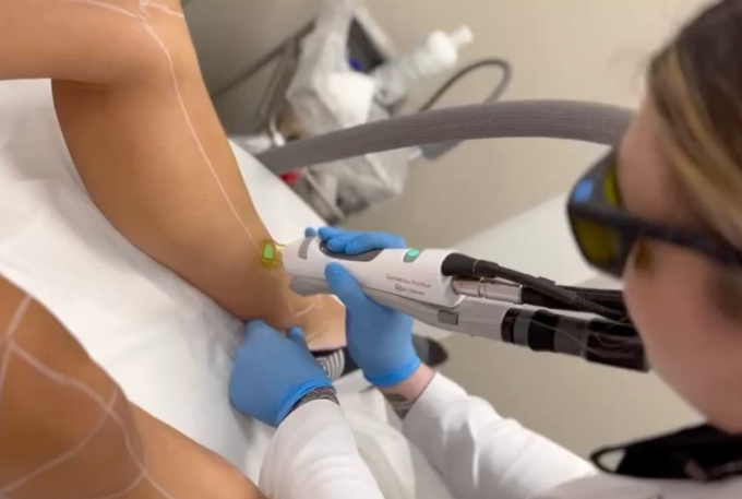 Why Do We Use the Candela GentleMax Pro at Satori Laser?