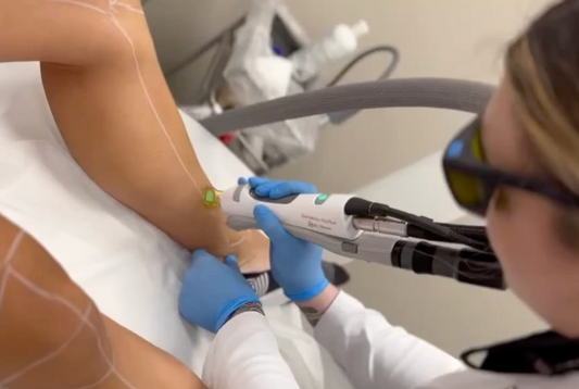 Why Do We Use the Candela GentleMax Pro at Satori Laser?