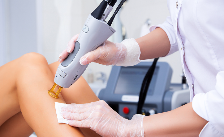 The Importance of Pain Tolerance in Successful Laser Hair Removal