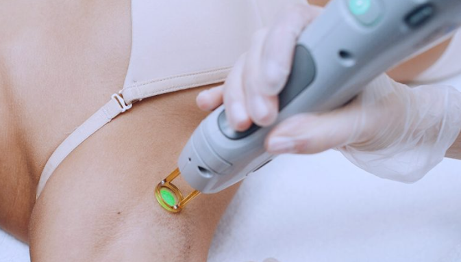 Top 5 Questions About Laser Hair Removal: What You Need to Know