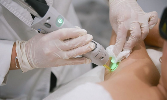 How Does Laser Hair Removal Really Work?