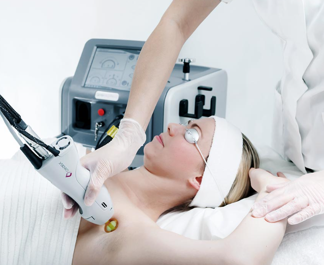 What is the Cryogen System in Laser Hair Removal?