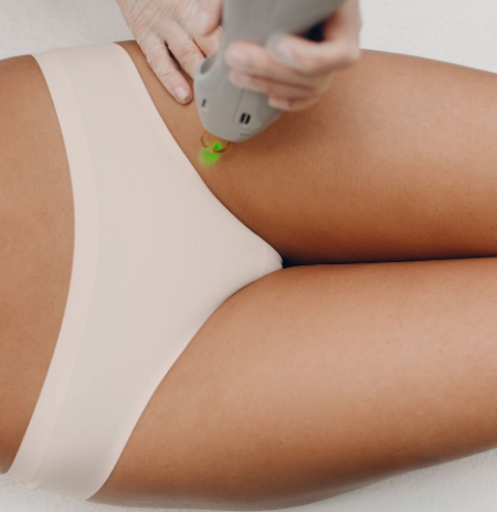 Brazilian Laser vs. Bikini Line: What’s the Difference?