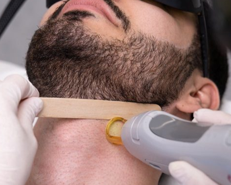 How Laser Hair Removal Empowers Trans and Non-BinaryClients
