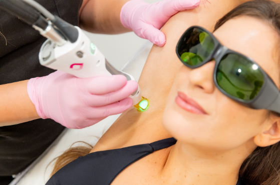 Halfway Smooth Isn’t the Goal: What Happens If You Stop Laser Hair Removal Mid-Treatment?
