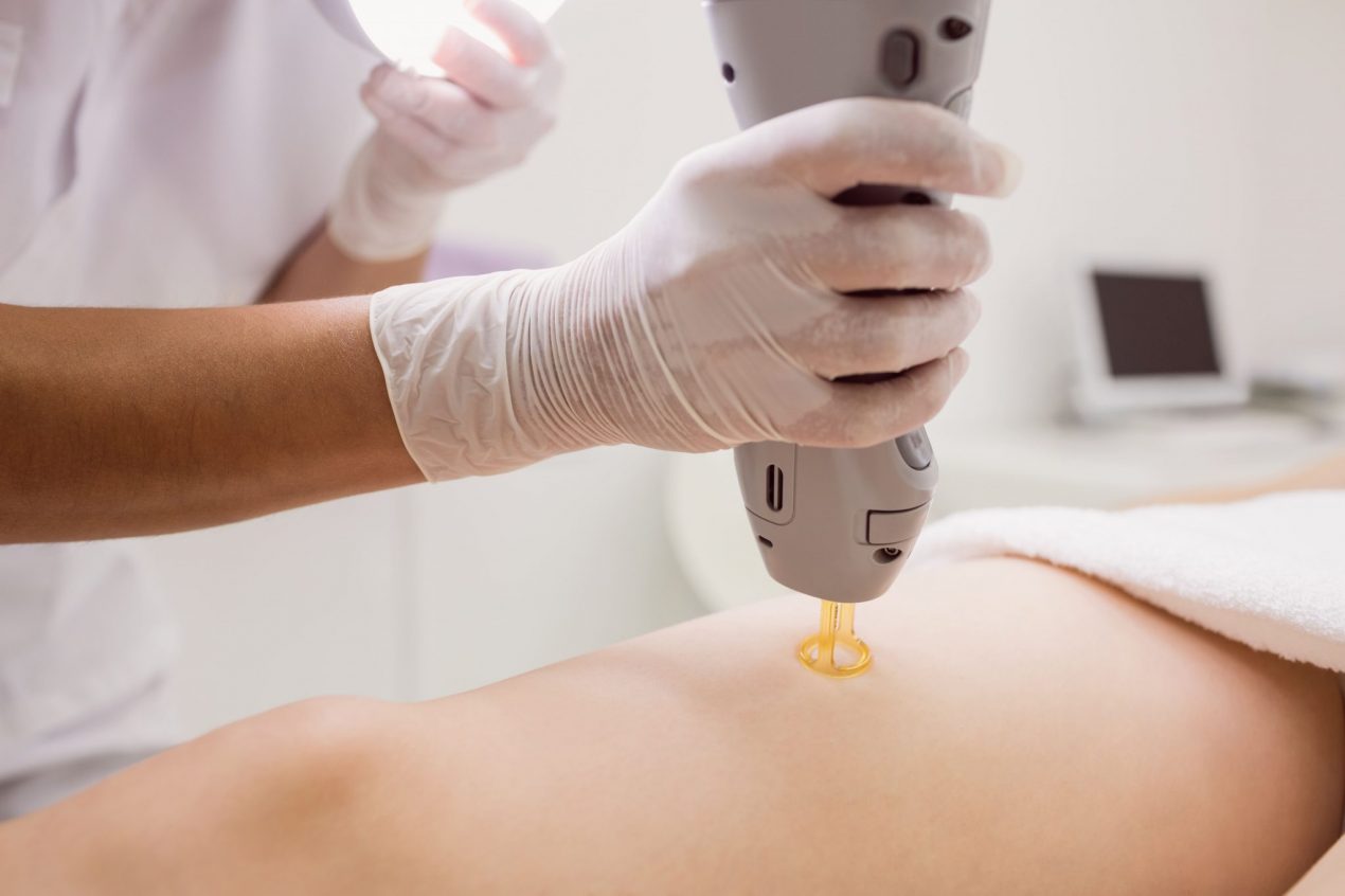 Why I Chose Laser Hair Removal for the Brazilian Area?