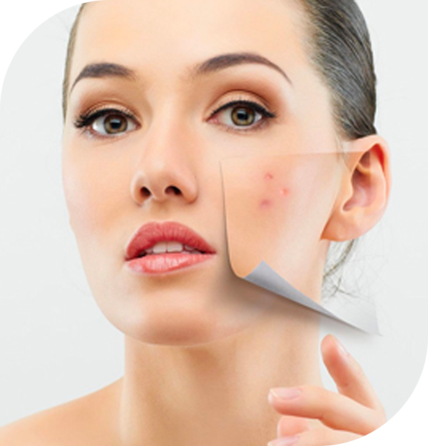 Benefits of having eMatrix done!