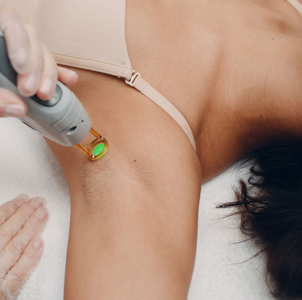 How Many Treatments to Get Permanent Results with Laser Hair Removal?