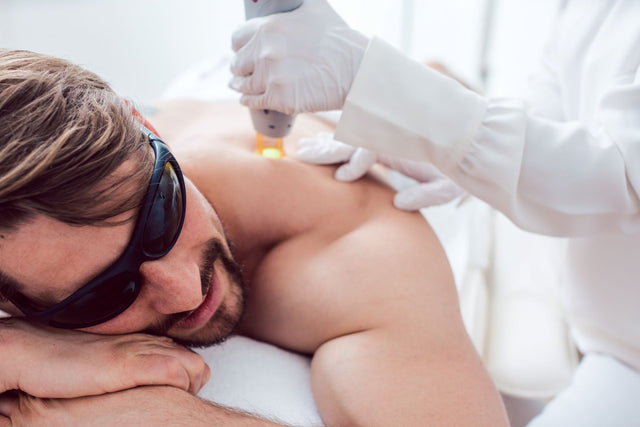 Laser Hair Removal for Men: Discover How It’s More Popular Than Ever