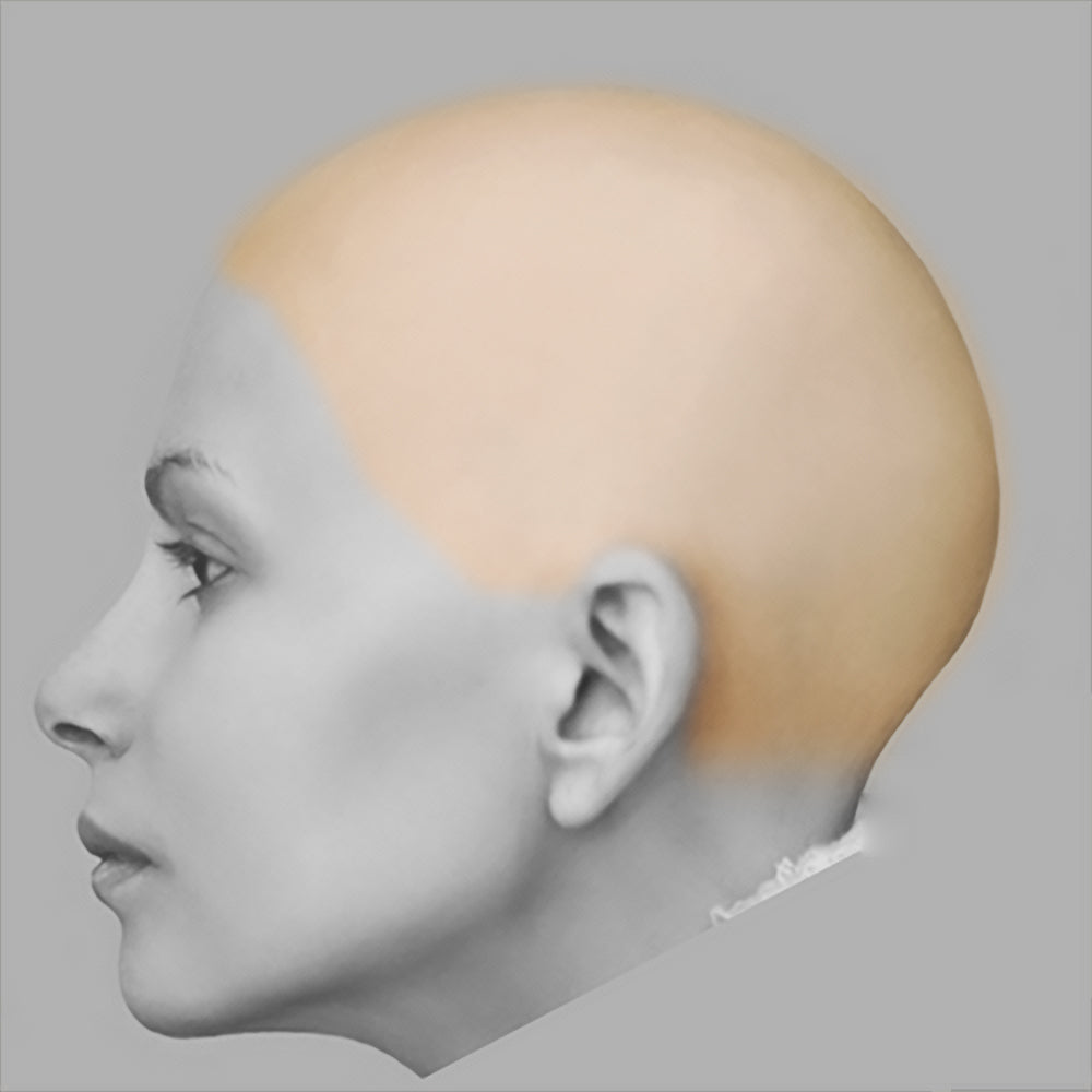Scalp