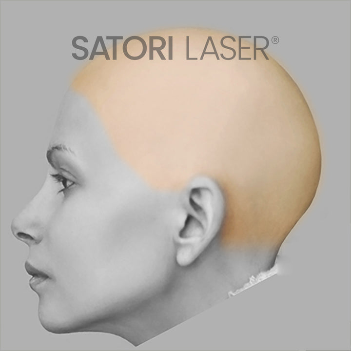 Scalp Laser Hair Removal Satori Laser