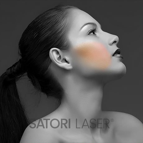 Cheeks eMatrix (Unisex) - Satori Laser