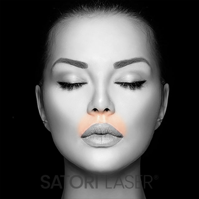 Lip Upper (F) - Satori Laser