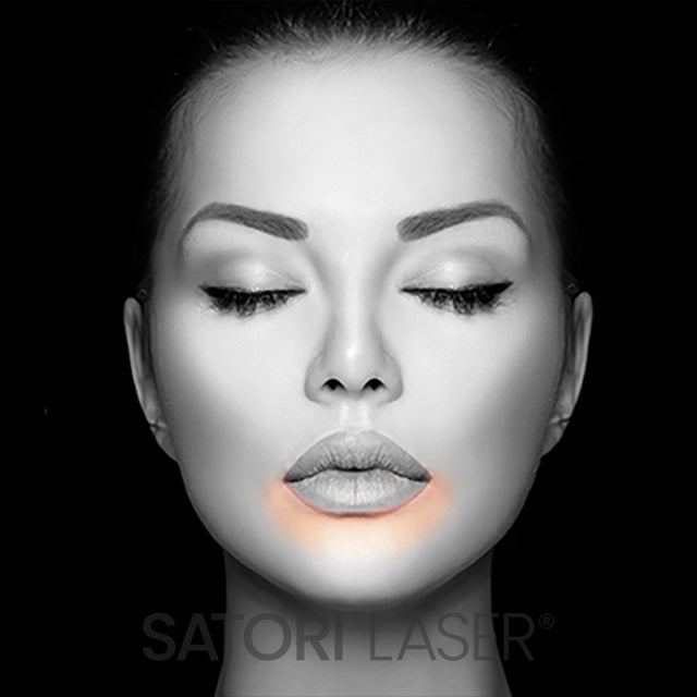 Lower Lip (F) - Satori Laser