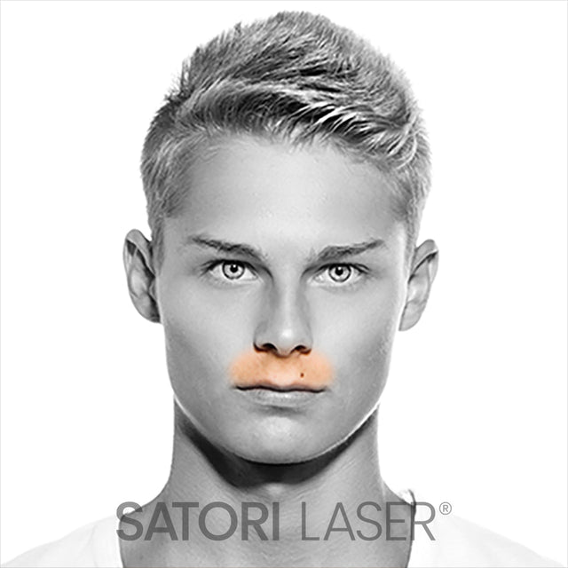 Upper Lip - Satori Laser