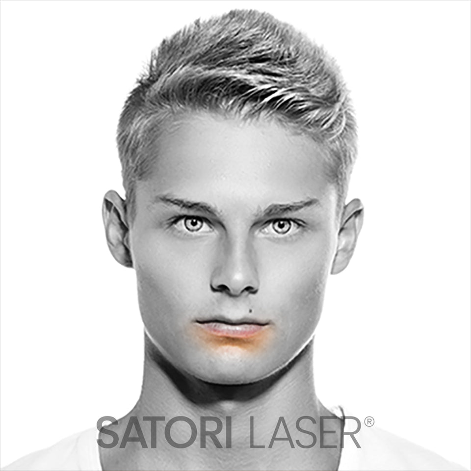 Lower Lip - Satori Laser