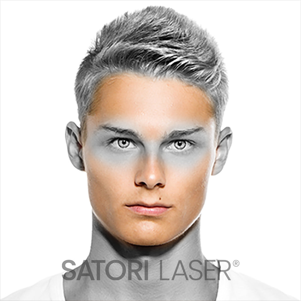Full Face - Satori Laser