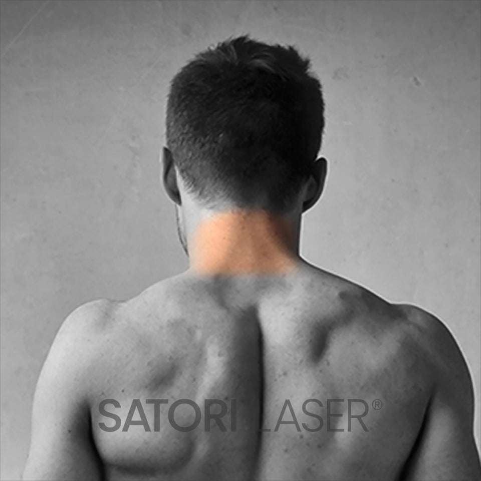 Back of Neck - Satori Laser