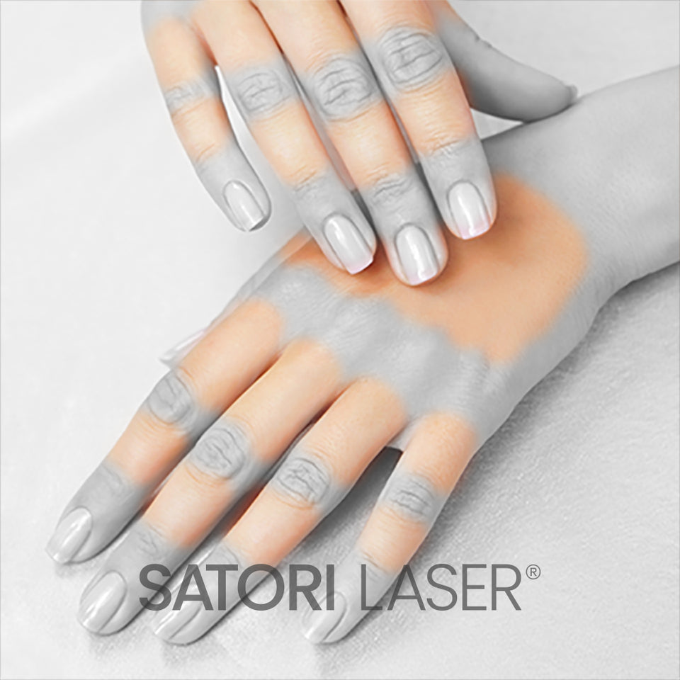 Hands (F) - Satori Laser