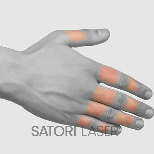 Fingers - Satori Laser