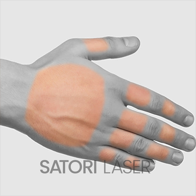 Hands - Satori Laser
