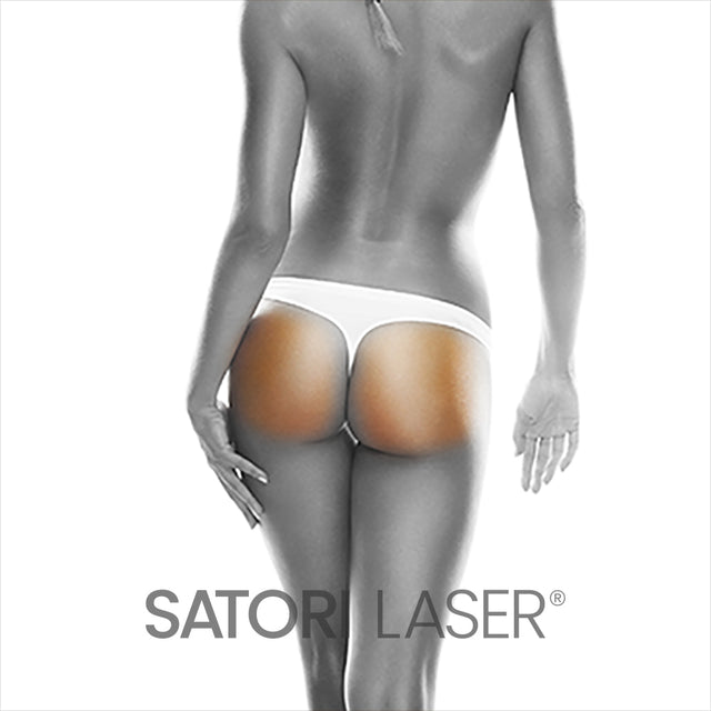Buttocks (F) - Satori Laser