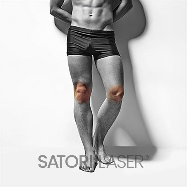 Knees - Satori Laser