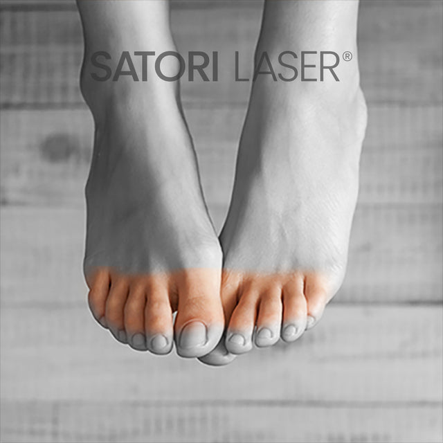 Toes (F) - Satori Laser