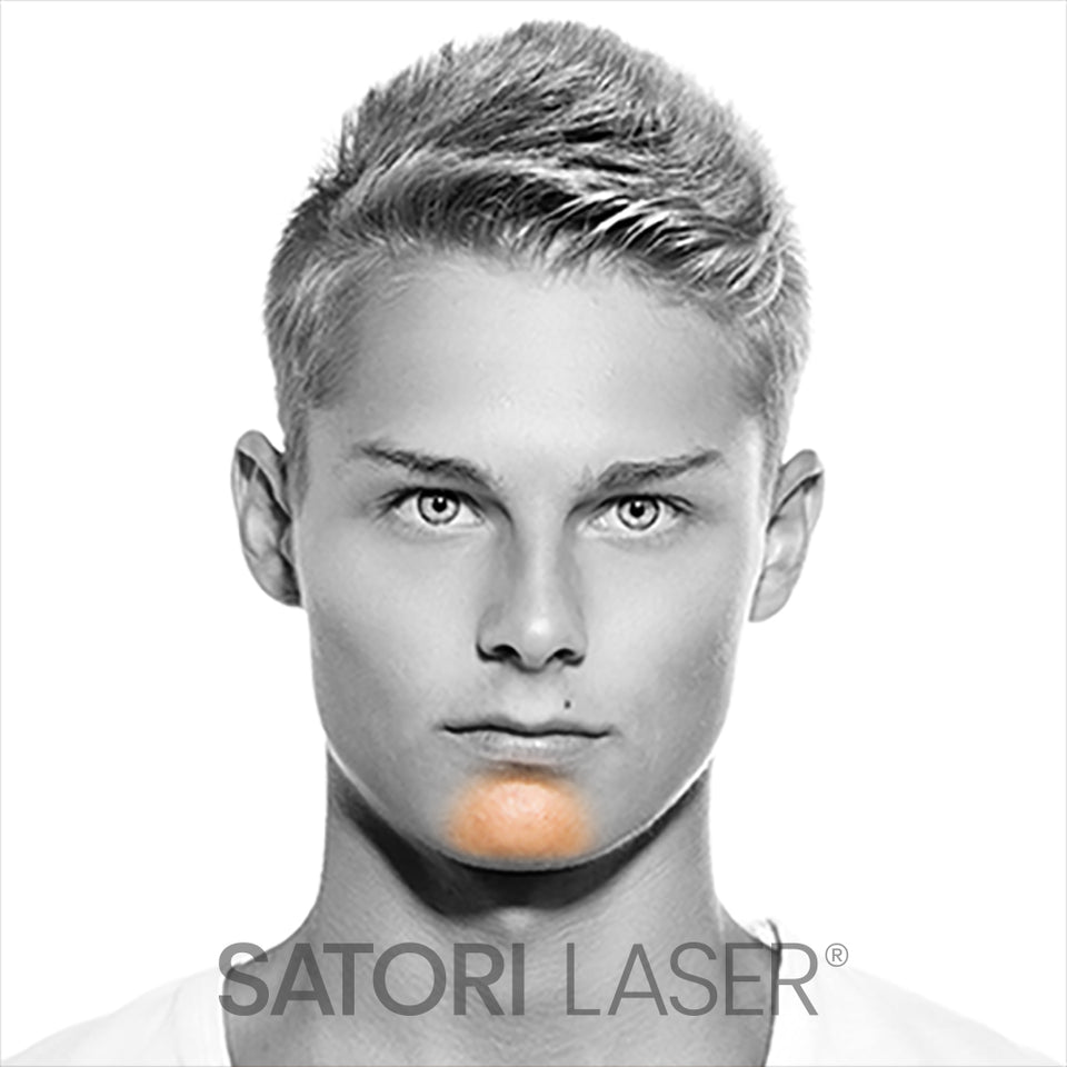 Chin - Satori Laser