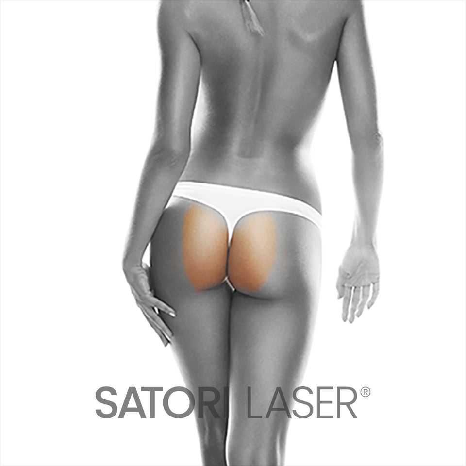 Buttcheeks 3 inches (F) - Satori Laser
