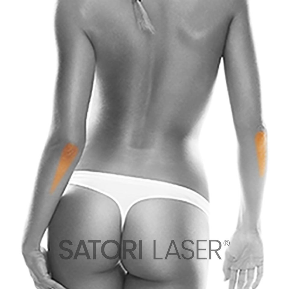 Elbow Extension (F) - Satori Laser