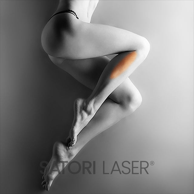 Side of Lower Legs (F) - Satori Laser